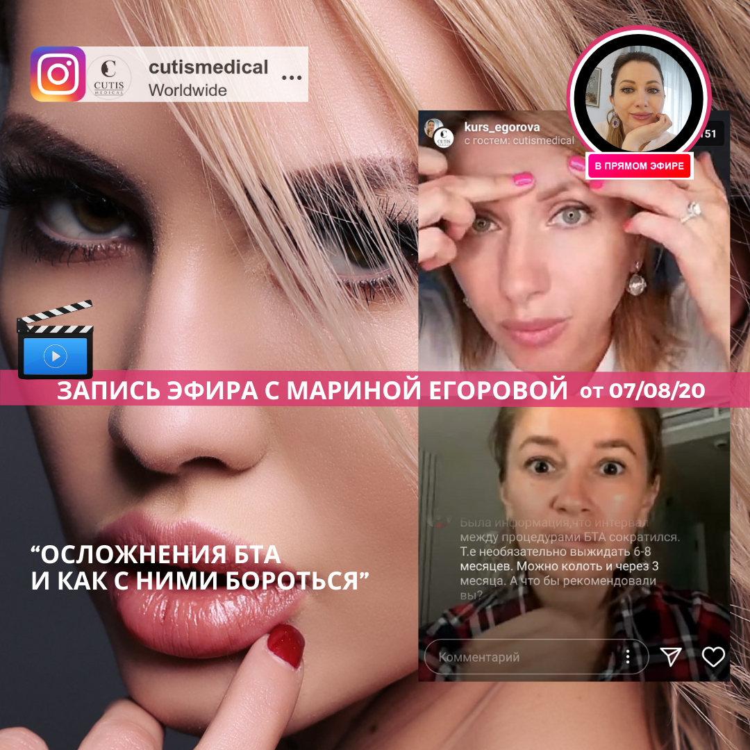 OTSEÜLEKANDE SALVESTUS Instagramis "BTA Tüsistused ja Kuidas Neid Lahendada"