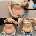 Cutis Medical Group. Musculpting Machine. - Image 7