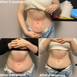 Cutis Medical Group. Musculpting Machine. - Image 7