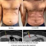 Cutis Medical Group. Musculpting Machine. - Image 8