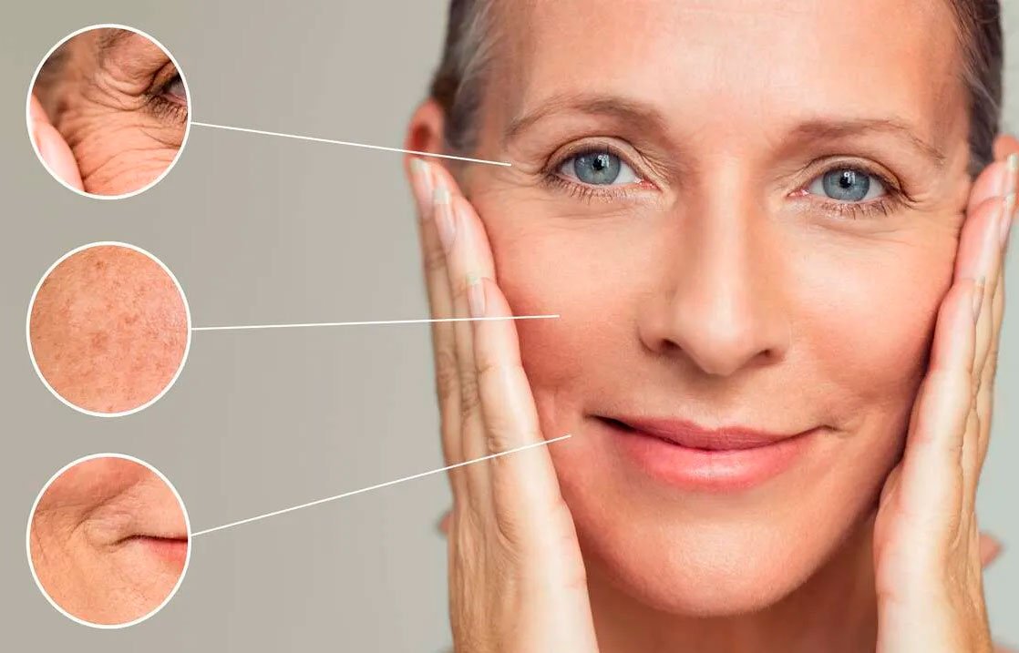 preparations for vascular mesotherapy